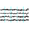 brainwaves