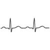 EKG Welle Sinusrhythmus