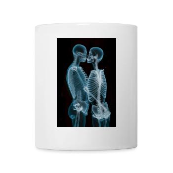 Ein Paar Skelette umarmt und geküsst Röntgen X-Ray - Tasse - Weiß - Vorne