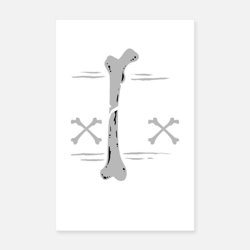 Leg fracture Broken thigh Poster 8" x 12" (20x30 cm)