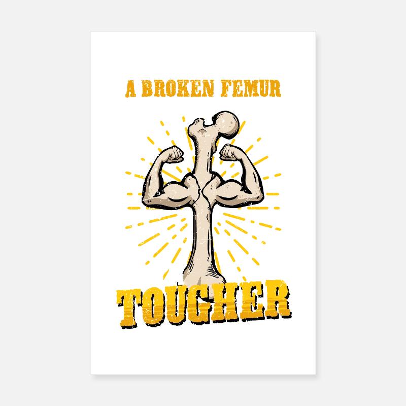 Fracture de la jambe Cuisse cassée Poster 20 x 30 cm