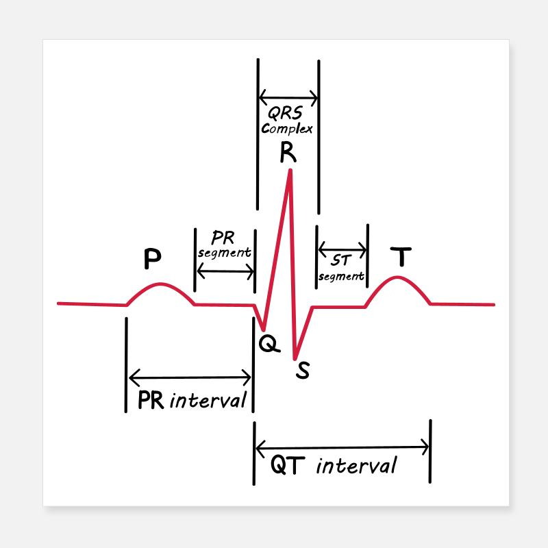 ECG Poster 8" x 8" (20x20 cm)