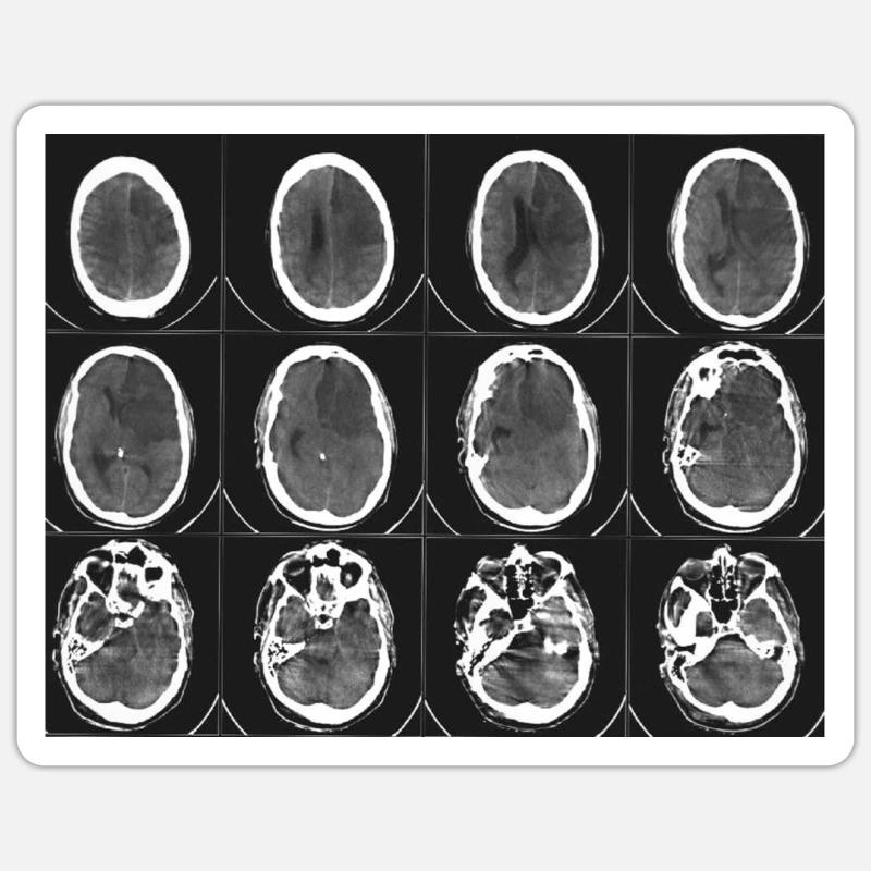 Brain, brain Sticker size S (10 x 10 cm)