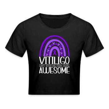 Vitiligo World Vitiligo Day - Frauen Cropped T-Shirt - Schwarz - Vorne - Marisol (170cm)