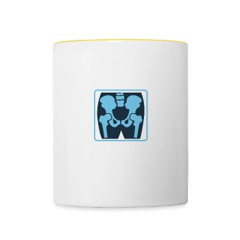 Sonograph Mode Medical Frontliner Gift - Contrasting Mug - white/yellow - Front