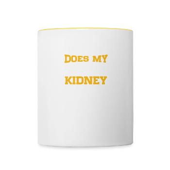 Looks My New Kidney Good In This Kidney Recipient - Contrasting Mug - white/yellow - Front