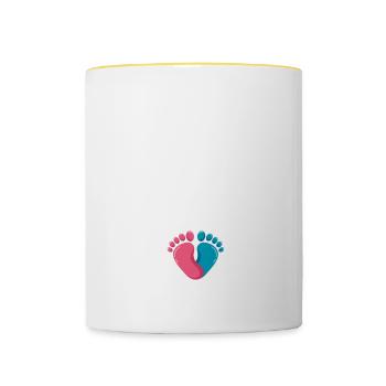 I Miss Beer 2 - Contrasting Mug - white/yellow - Front