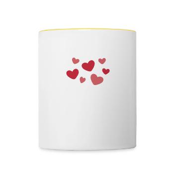 Forehead Kisses Are Underrated 4 - Contrasting Mug - white/yellow - Front
