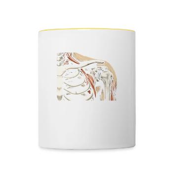 Chirurgie de remplacement de l’épaule bionique Récupération articulaire - Mug contrasté - blanc/jaune - Devant