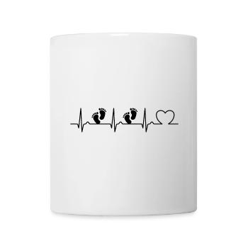 ECG Curve - Heart Curve - Baby - Twins - Mug - white - Front