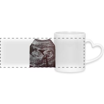 Chargement de bébés... Soyez patient ! Ultrason - Mug panoramique avec anse en forme de cœur - blanc - Devant