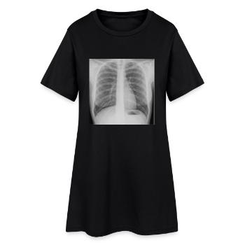 Lunge - Nichtraucher - Frauen T-Shirt-Kleid - Schwarz - Vorne