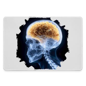 The other day at the X-ray - everything is fine - Large Gaming Mouse Mat - grey - Front