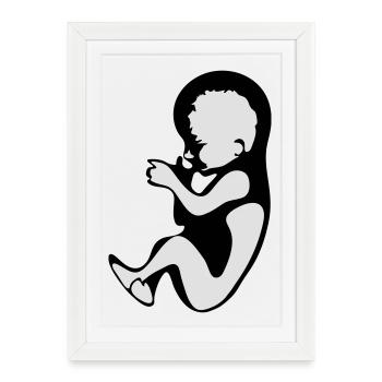 Grossesse - Fetus - Baby - Affiche encadrée (27 × 37 cm) - blanc - Devant