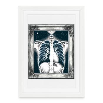 Art médical Thoracique Peinture Radiologie - Affiche encadrée (27 × 37 cm) - blanc - Devant