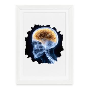 L’autre jour à la radiographie - tout va bien - Affiche encadrée (27 × 37 cm) - blanc - Devant