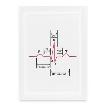 Ecg - Affiche encadrée (27 × 37 cm) - blanc - Devant
