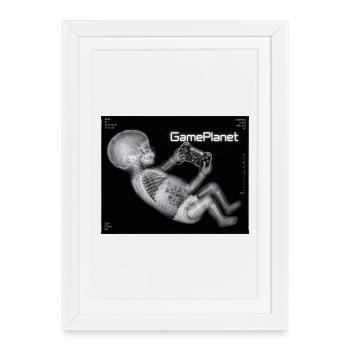 X-ray baby with game controller - Framed poster (27 × 37 cm) - white - Front