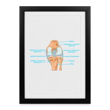 Physio genou d’anatomie Bracelet croisé Ménisque - Affiche encadrée (27 × 37 cm) - noir - Devant