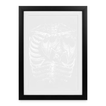 corps de squelette à rayons X avec chauve-souris - Affiche encadrée (27 × 37 cm) - noir - Devant