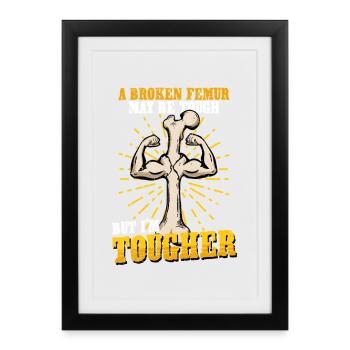 Fracture de la jambe Cuisse cassée - Affiche encadrée (27 × 37 cm) - noir - Devant