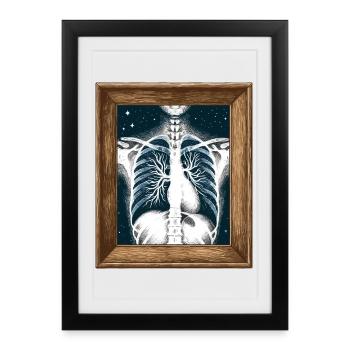 Art médical Thoracique Peinture Radiologie - Affiche encadrée (27 × 37 cm) - noir - Devant