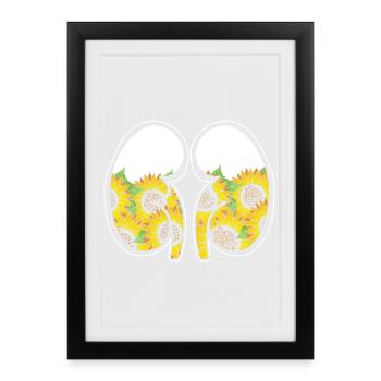 Don d’organes, transplantation de reins - Affiche encadrée (27 × 37 cm) - noir - Devant