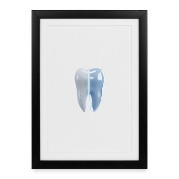 healthy-broken-tooth-before-after-3d - Framed poster (27 × 37 cm) - black - Front
