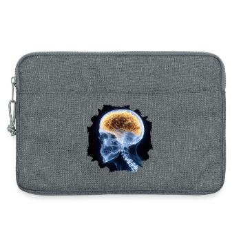 The other day at the X-ray - everything is fine - Laptop bag 13" - heather grey - Front