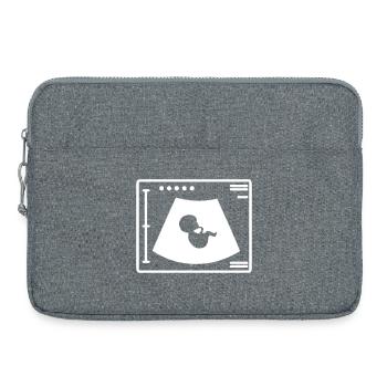 Un bébé dans l’utérus - Sacoche pour ordinateur portable 15 pouces - gris chiné - Devant