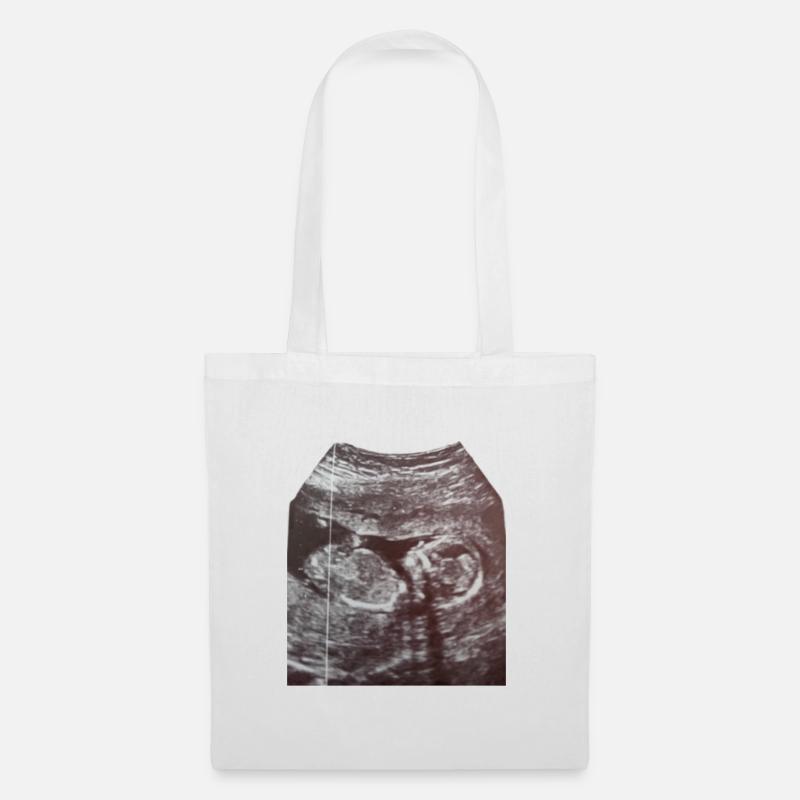 Babyloading … Bitte noch etwas Geduld! Ultraschall - Stoffbeutel - Weiß