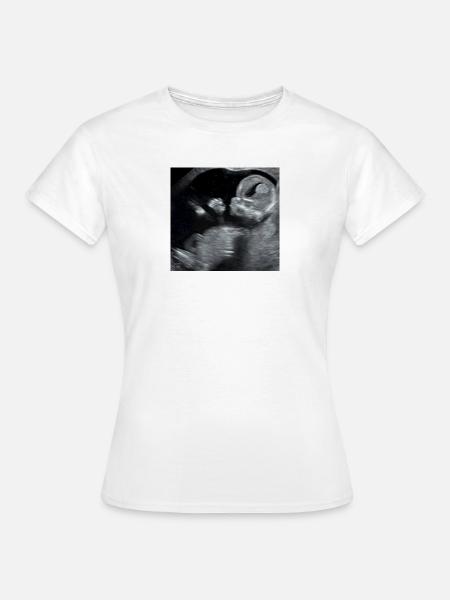 Fötus Silhouette Ultraschall - Frauen T-Shirt - Weiß
