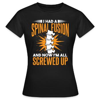 J’ai eu une fusion vertébrale - T-shirt Femme - noir - Devant - AI Model Female 172 dark (172cm)