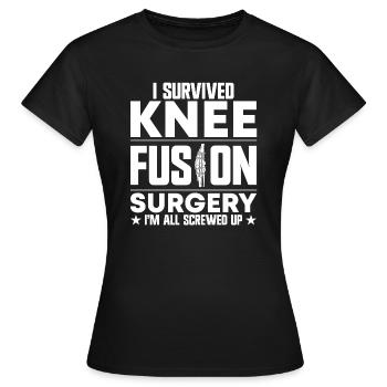 Remplacement du genou - T-shirt Femme - noir - Devant - AI Model Female 172 dark (172cm)