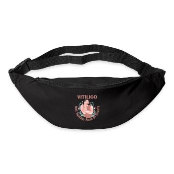 Vitiligo Just Another Form Of Beauty Male Model - Bum bag - black - Front