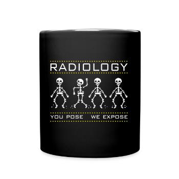Radiologie - tanzende Skelette - Tasse einfarbig - Schwarz - Vorne