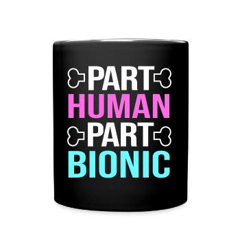 Chirurgie du genou Chirurgie du genou - Mug uni - noir - Devant