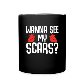 Open-heart surgery - Full Colour Mug - black - Front