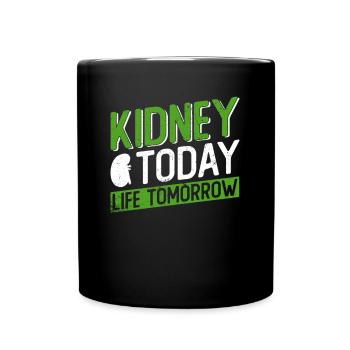 Organspender Niere Organtransplantation - Tasse einfarbig - Schwarz - Vorne