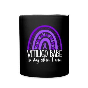 Vitiligo World Vitiligo Day - Tasse einfarbig - Schwarz - Vorne
