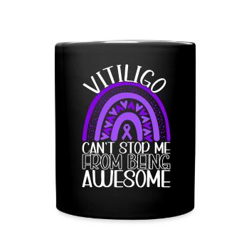 Vitiligo World Vitiligo Day - Tasse einfarbig - Schwarz - Vorne