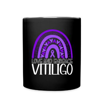 Vitiligo World Vitiligo Day - Tasse einfarbig - Schwarz - Vorne