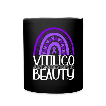 Vitiligo World Vitiligo Day - Tasse einfarbig - Schwarz - Vorne