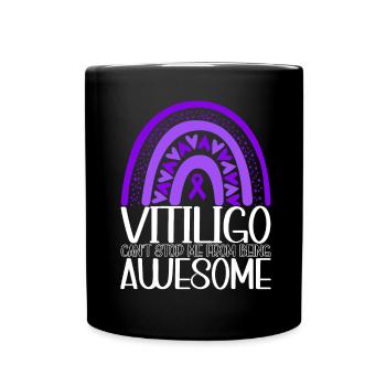 Vitiligo World Vitiligo Day - Tasse einfarbig - Schwarz - Vorne
