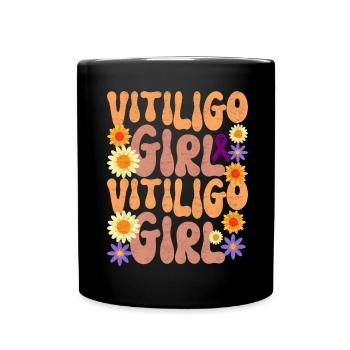 Vitiligo World Vitiligo Day - Tasse einfarbig - Schwarz - Vorne