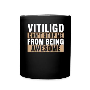 Vitiligo World Vitiligo Day - Tasse einfarbig - Schwarz - Vorne