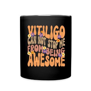 Vitiligo World Vitiligo Day - Tasse einfarbig - Schwarz - Vorne