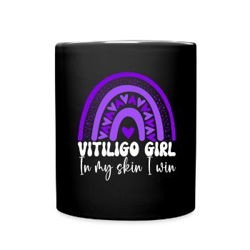 Vitiligo World Vitiligo Day - Tasse einfarbig - Schwarz - Vorne