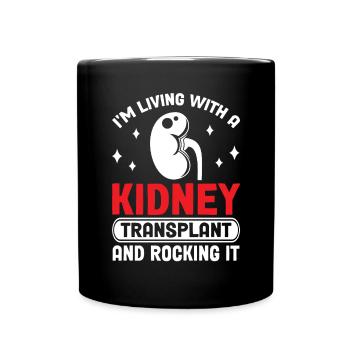 Nierentransplantation Organspender Nierenoperation - Tasse einfarbig - Schwarz - Vorne