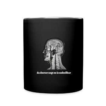 es is unheilbar... bayerischer Spruch - Tasse einfarbig - Schwarz - Vorne